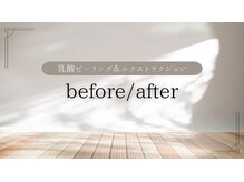 ライカブルー(RaicA BluE)/お客様の施術前/施術後の写真