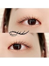 トリコ 調布(TRICO)/メーテルロッド