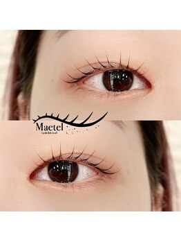 トリコ 調布(TRICO)/メーテルロッド