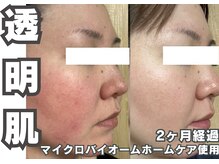 フェイス(FACE)/通わないエステ経過