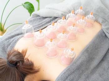 鍼グリッター 岡山本院(鍼Glitter.)/むくみスッキリ☆吸い玉