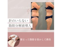 コンバートビューティーオタイ(ConBert Beauty otai)