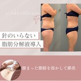 コンバートビューティーオタイ(ConBert Beauty otai)