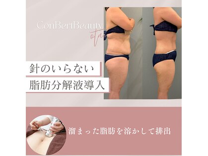 コンバートビューティーオタイ(ConBert Beauty otai)の写真