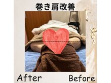 レーヴ(Reve)の雰囲気（たった10秒の施術で巻き肩改善♪）