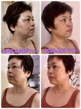 サロン ド ピラティス ラワンデル(salon de pilates)/小顔フェイシャルモニター