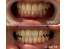 グレース バイ ジェリー(Grace×JERRY)/