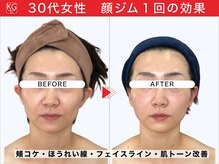 顔ジム 麻布店/30代女性顔ジム１回の効果
