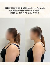 ウィータ とうの鍼灸整骨院(vita)/ダイエット