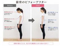 ロム キング/猫背が引き起こす様々な不調たち