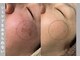 コンフィデンスサロン(Confidence Salon)の写真/【プラズマシャワー&美容液導入で肌のお悩みを根本から改善♪】お肌の内側からうっとり水光肌へ導きます♪