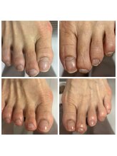 ドクターネイル爪革命 十条店/爪ケア