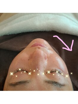 アンレーヴ/小顔に特化したフェイシャル