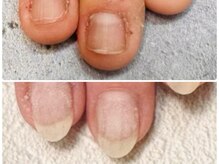 グレースレディ/ロングネイルも楽しめます