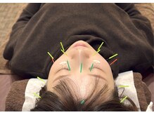 円山よもぎ鍼灸整骨院/美容鍼【クマ改善＊しわ予防】