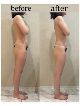 シェリーナ(cherieNa)/ブライダルケアも姿勢から