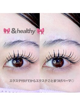 ラーレ(Rare)/エクパーマ