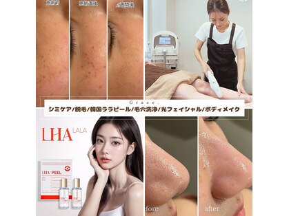 グレイス(Grace)の写真