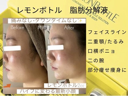 マスカレード 品川(Masquerade)の写真