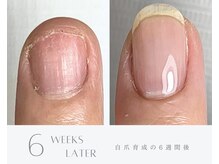 エレアネイル(elea.nail)の雰囲気（遺伝だと諦めてた爪も、一緒に自信が持てる爪へと育てましょう。）