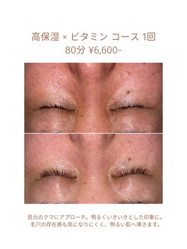 ハピスリー(Hapisley)/掲載許可、頂いております。