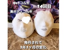 カンコルギセラピー 広島幟町店(KAN)/石膏パックの見比べ　14回の変化