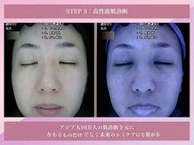 花蔵 浦和コルソ店/【高性能肌診断】