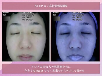 花蔵 浦和コルソ店/【高性能肌診断】