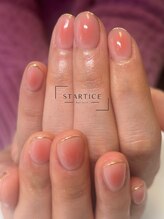 スターチス(STARTICE)/定額シンプルコース