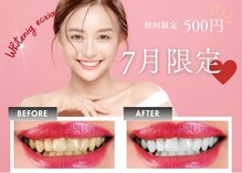 エクシアホワイトニング 八王子店