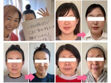 小顔矯正サロン ブルーム