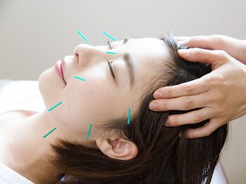 アイメディカル鍼灸整骨院【美容鍼/マタニティ/骨盤矯正】の写真/巷で話題沸騰×当店大人気の美容鍼で、シミしわを徹底改善★お客様のお肌本来の美しさを引き出します◎