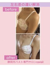 コライユ(corail)/ビフォーアフター