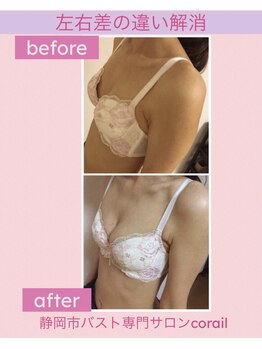 コライユ(corail)/ビフォーアフター