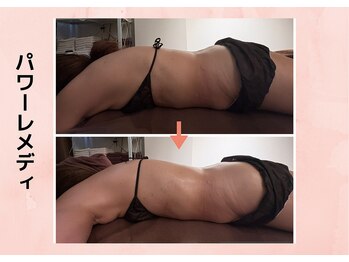 リラココ(リラcoco)/ハンドの3~5倍のパワーレメディ