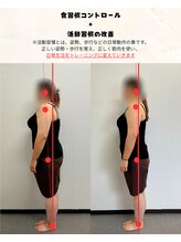 ウィータ とうの鍼灸整骨院(vita)/猫背改善