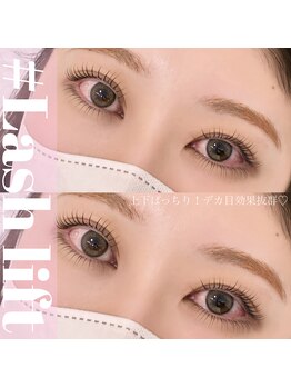 カナン(kanan)/ラッシュリフト上下