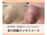 【毛穴ケア】毛穴皮脂すっきりコース（男女共OK）