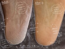ダイヤモンドボディの雰囲気（サンダルの準備は出来てますか？今年のオシャレは、かかとから♪）