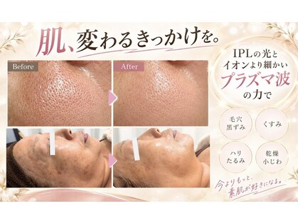 トータルビューティー ミミ(Total Beauty mimi)の写真
