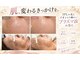 トータルビューティー ミミ(Total Beauty mimi)の写真