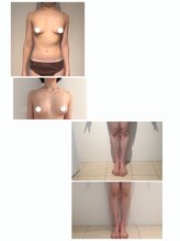 美人バスト 名古屋店/【痩身・ダイエット】 名古屋/脚