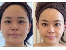 美人バスト 岡崎店/小顔術コルギには自身があります