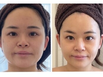 美人バスト 岡崎店/小顔術コルギには自身があります