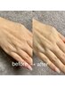 【HAND】高濃度ヒト幹細胞＋細胞エクソソームハンドエステ 6600→5500