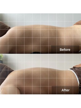 アサヒナ(ASAHINA)/50代お客様ビフォーアフター