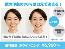 ホワイトニングカフェ 京橋店