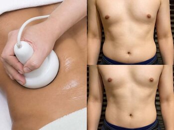 ゼロ アンド リセット(0ZERO&RESET)の写真/【大人の魅せボディ、完成】トリプルアタックでセル脂肪を徹底的に撃退！血行促進や疲労回復までサポート◎