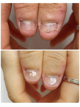 ココ ネイル サロン アンドスクール(COCO.NAIL SALON&SCHOOL)/爪噛みケア サポート