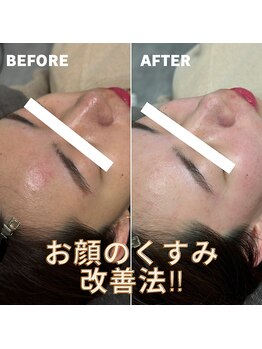 ベレア(BELEA)/くすみを撃退法！